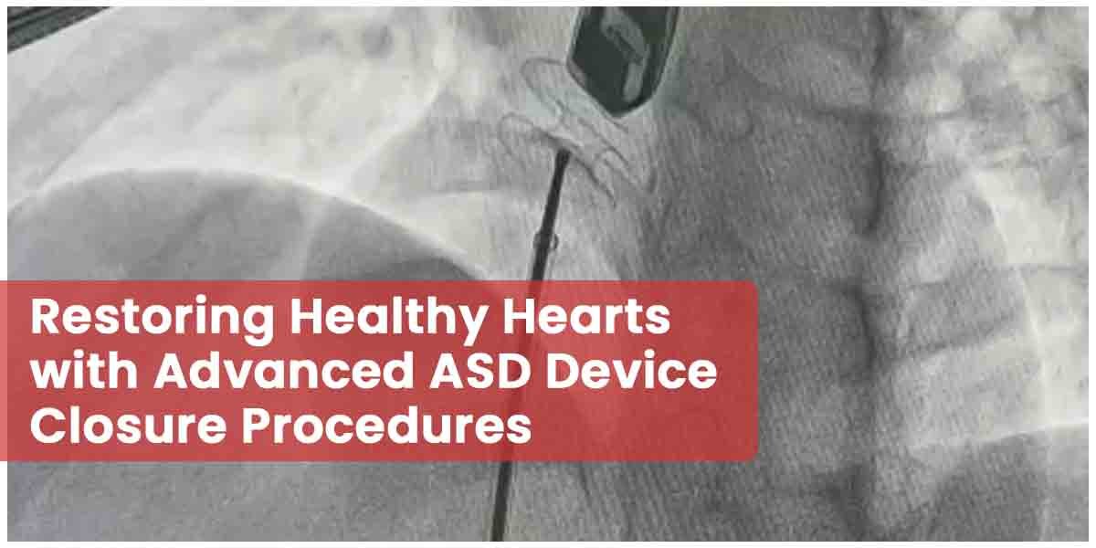 asd-device-closure-procedure